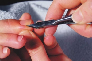 Профилактика вросших ногтей у детей