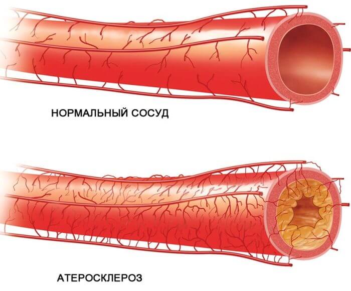 Таблица норм артериального давления