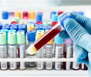 Цитомегаловирус в анализе крови: норма и возможные заболевания