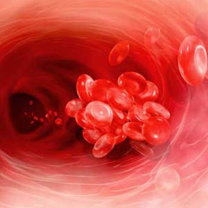 разжижение крови