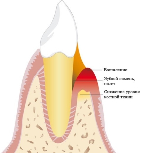 Симптомы, причины, виды