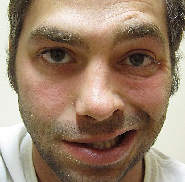 Чем опасна нейропатия