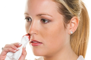 Причины носового кровотечения