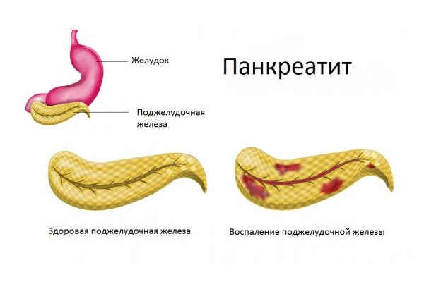 Причины болей