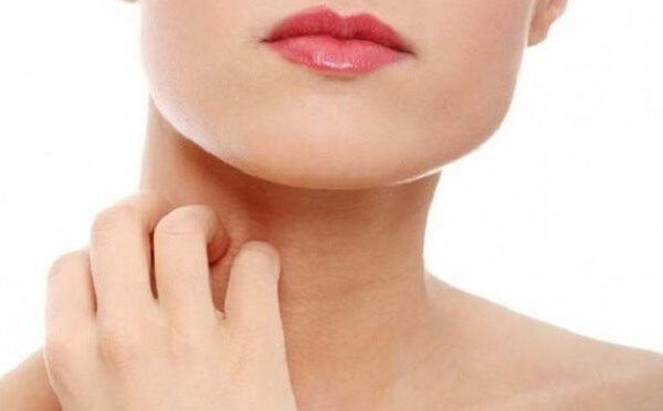 Холинергическая крапивница симптомы