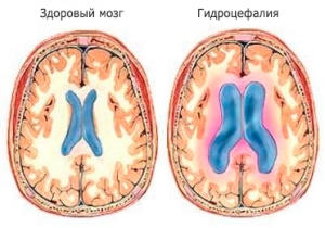 Причины возникновения