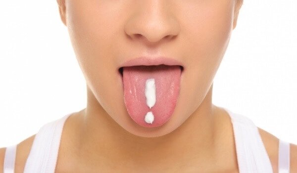 Кандидозный стоматит у взрослых