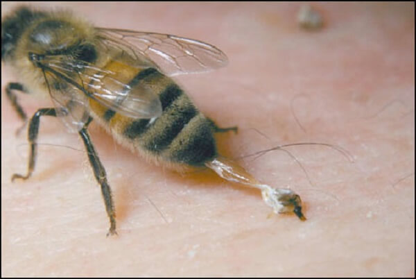 Лечение артроза пчелами