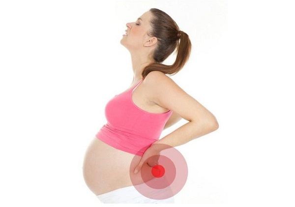 Мазь от радикулита при беременности