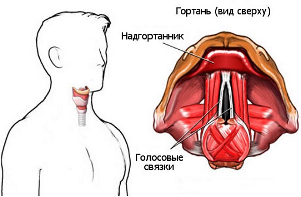 Острый ларингит что это 