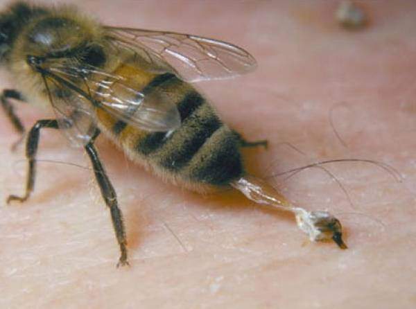 Пчелиный яд в составе Вариус 