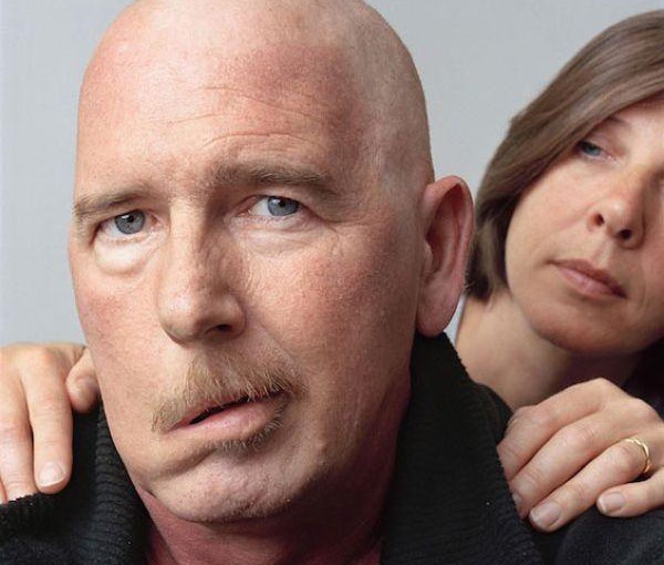 Симптомы инсульта