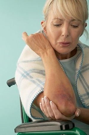 Методы лечения ушиба локтя