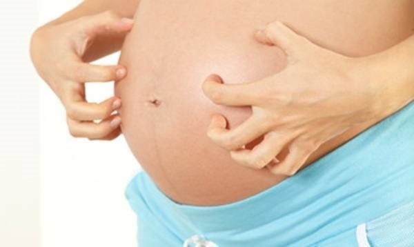 Желтуха и беременность