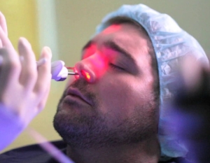 Баллонная синусопластика