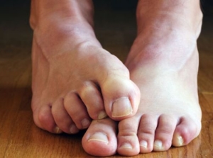 Причины заболевания и лечение синдрома беспокойных ног