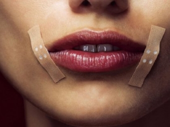 Как избавиться от заедов в уголках губ