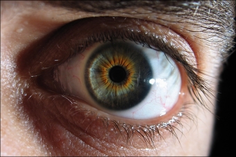 Что делать при отслоении сетчатки глаза