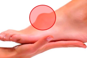 Симптомы патологии