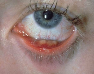 Причины развития