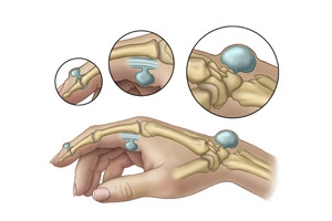 Основные причины патологии