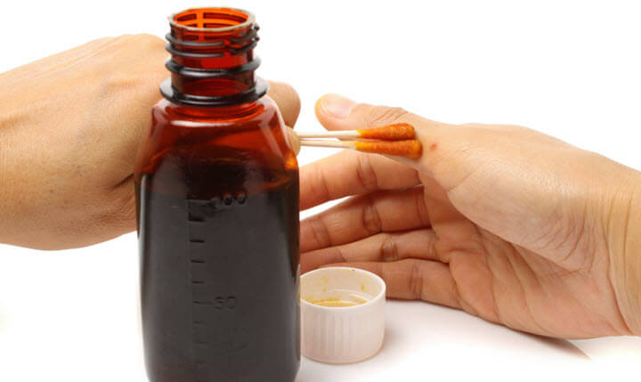 Лечение коленей средствами