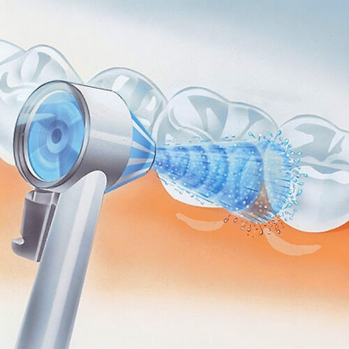 Ирригатор от кариеса