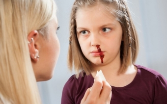 Что делать, если у ребенка идет кровь из носа