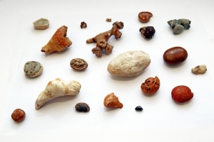 Классификация почечных камней
