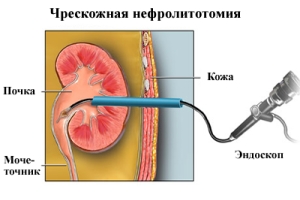 Оперативное лечение