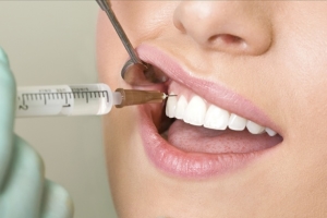 Терапевтическое лечение