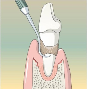 Способы оперативного лечения