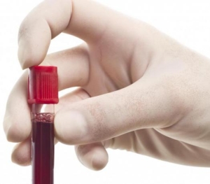 Как подготовитья к анализу крови