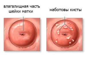 Особенности патологии