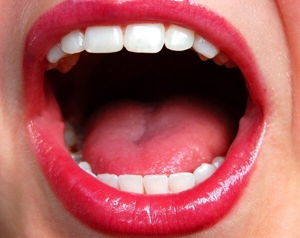 Кандидозный стоматит лечение