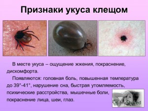 укус клеща