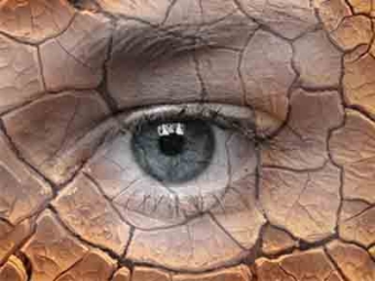 Синдром сухого глаза — лечение в домашних условиях