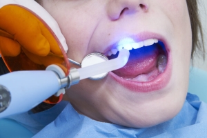 Болит и сводит зуб после лечения кариеса