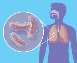 Инкубационный период туберкулеза
