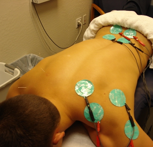 Физиотерапия при невралгии 