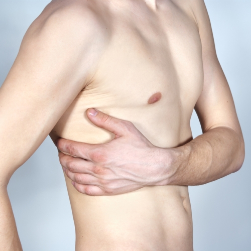 Лечим межреберную невралгию слева 